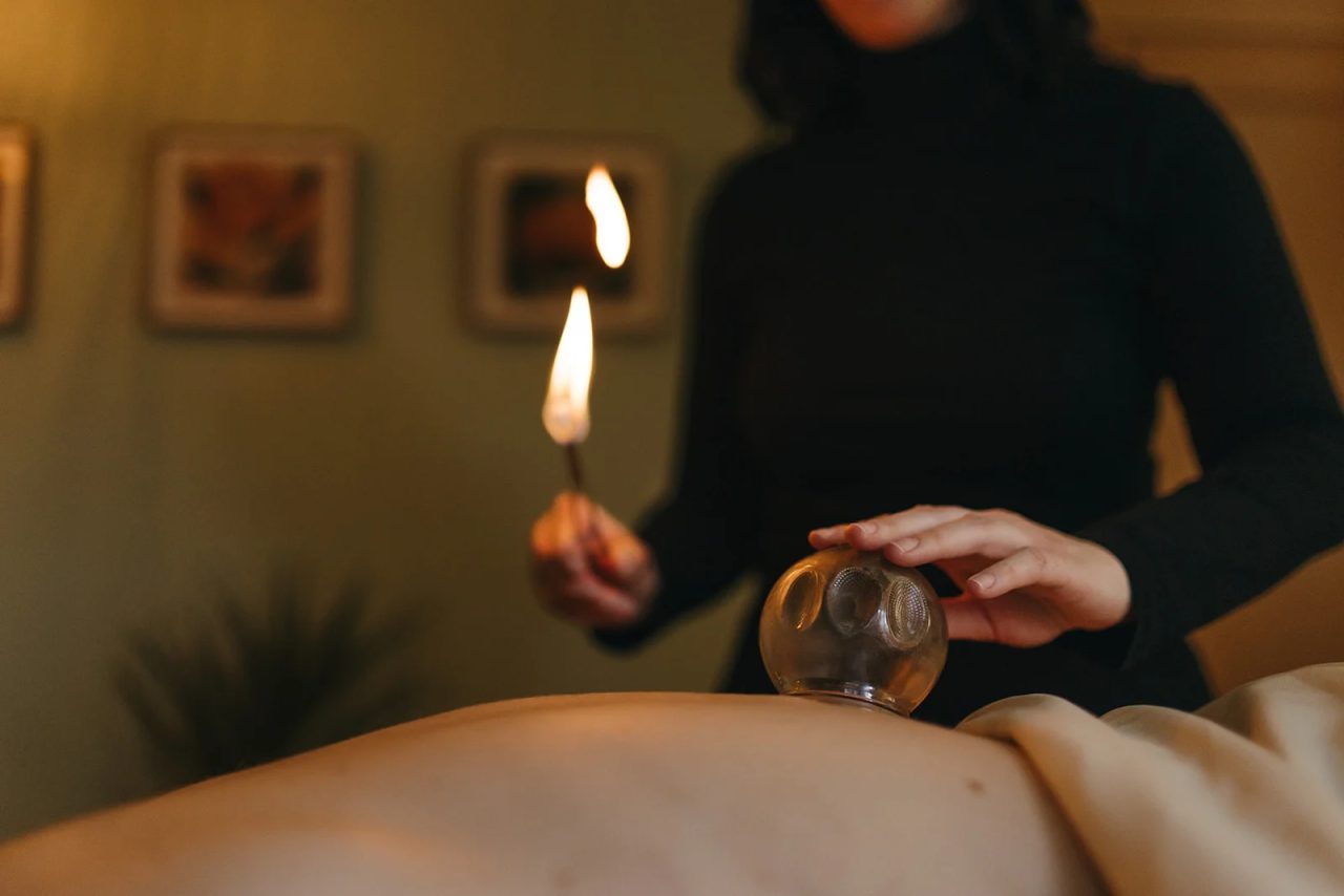 A practitioner sets warmed glass cups along a patient's back during fire cupping.